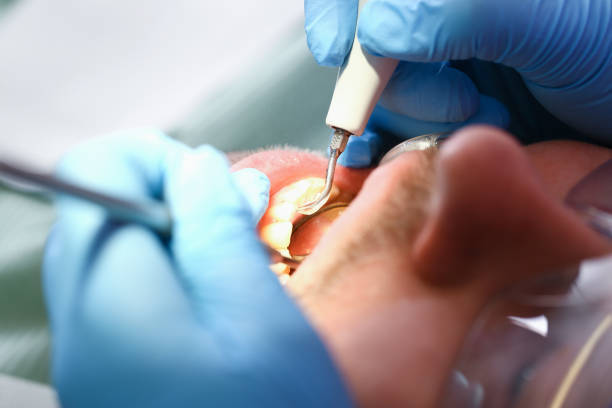 Best Walk-In Emergency Dentist in Kennesaw, GA