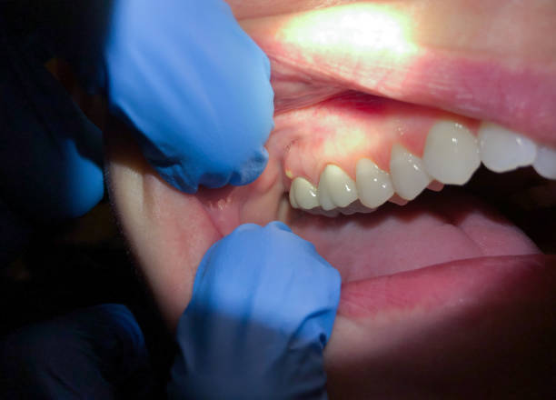 Best After-Hours Emergency Dentist in Kennesaw, GA