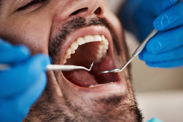 Best Walk-In Emergency Dentist in Kennesaw, GA